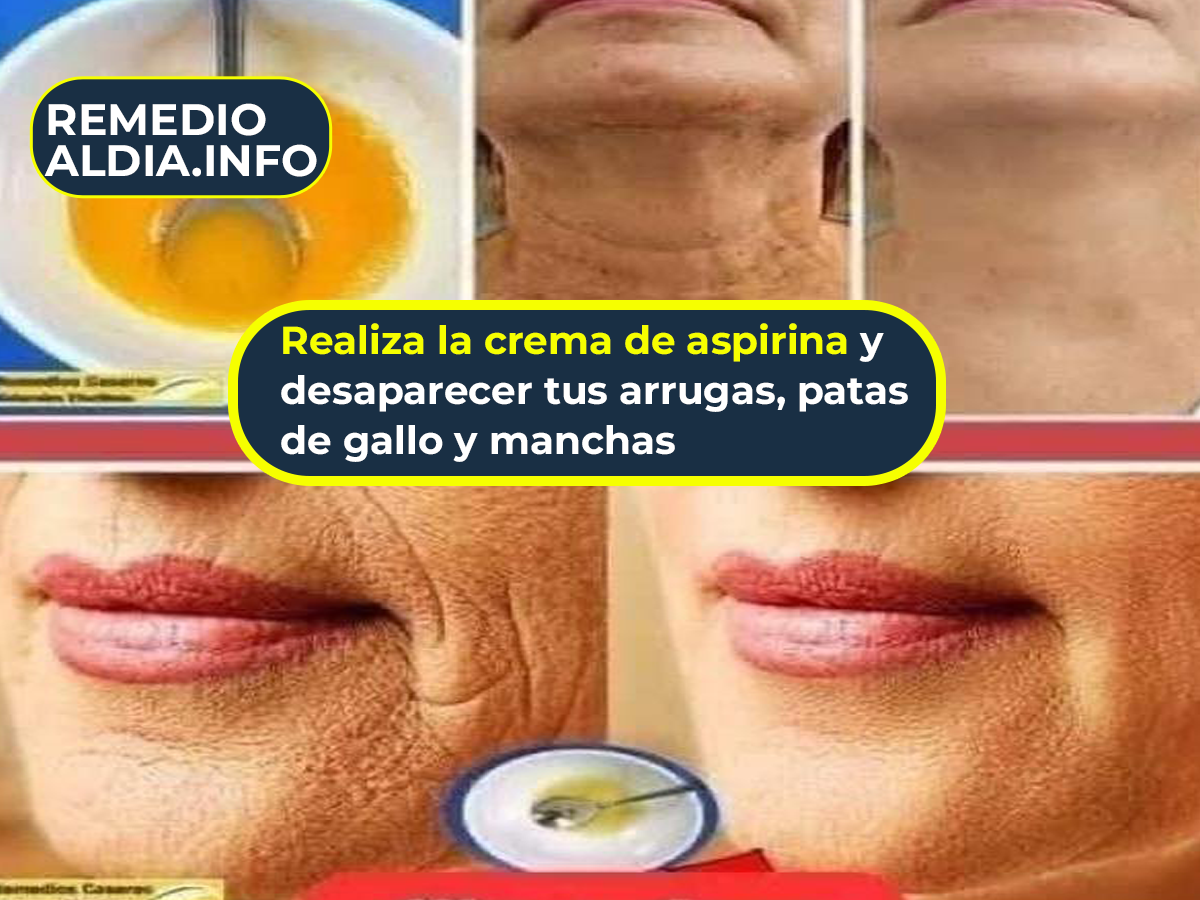 Realiza la crema de aspirina y desaparecer tus arrugas, patas de gallo y manchas
